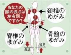 ゆがみ